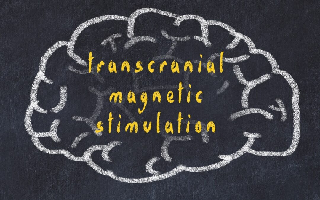 The Benefits of Transcranial Magnetic Stimulation